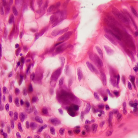 Microscopic view of pink and purple stained epithelial cells with visible nuclei.