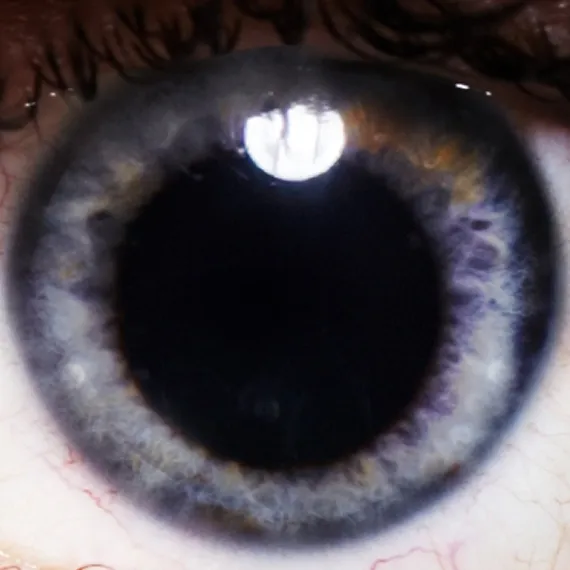 Close-up image of a human eye showing the iris with blue and grey tones and a large dark pupil.
